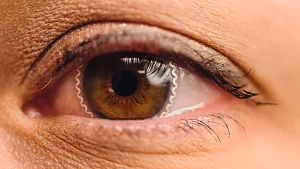 Lentillas inteligentes que pueden ayudar a prevenir el glaucoma.